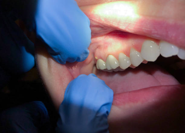 Best Same-Day Emergency Dentist in Honey Grove, TX